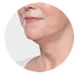 A woman's face, chin, and neck